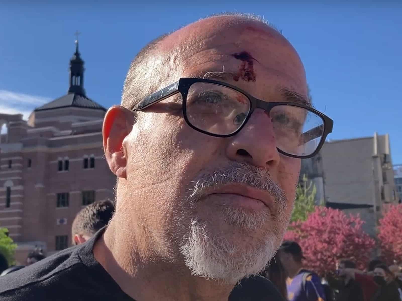 A photo shows a close view of the face of Samer Alatout, who has blood on his forehead coming from a small cut and on his glasses. UW-Madison’s Library Mall and surrounding buildings are visible in the background.
